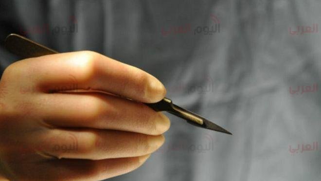 ختان الاناث