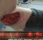 أكتشف 10 نصائح للأقلاع عن التدخين،وما هي أضراره!!