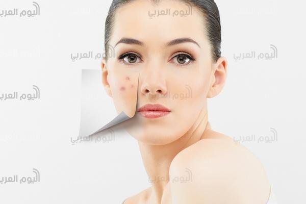 عدة اخطاء تجنبيها حتي لا تصابي بحب الشباب
