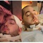 عدة اخطاء تجنبيها حتي لا تصابي بحب الشباب