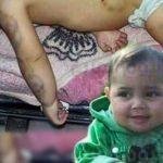 شاهد: فيفي عبدة مرتدية ملابس ممزقة