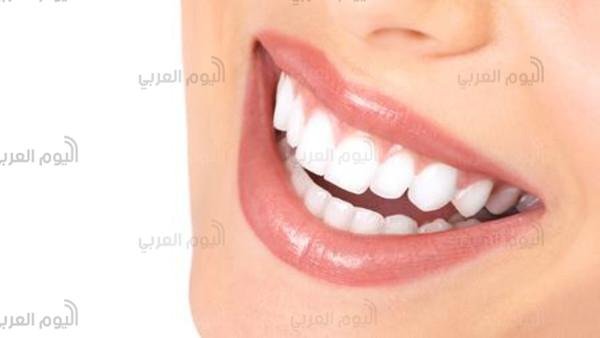 الأسنان