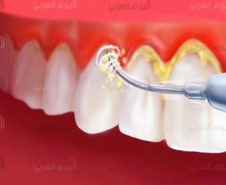 الأسنان