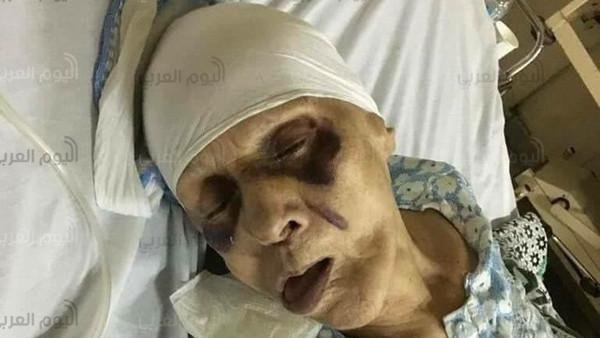 ابن عاق يضرب أمه
